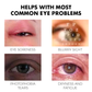 Ourlyard™ Treatment EyeProblems SolutionDrops